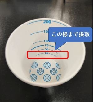 尿量